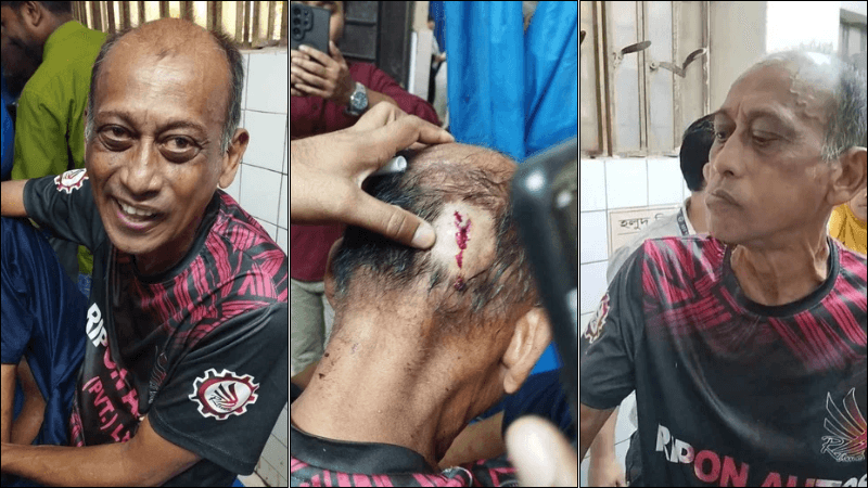 যশোরে অভিনেতা সমু চৌধুরীকে লাঠিপেটা, মাথায় সেলাই যশোরে অভিনেতা সমু চৌধুরীকে লাঠিপেটা, মাথায় সেলাই
