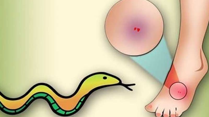 বরিশালে সাপের কামড়ে তরুণীর মৃত্যু বরিশালে সাপের কামড়ে তরুণীর মৃত্যু